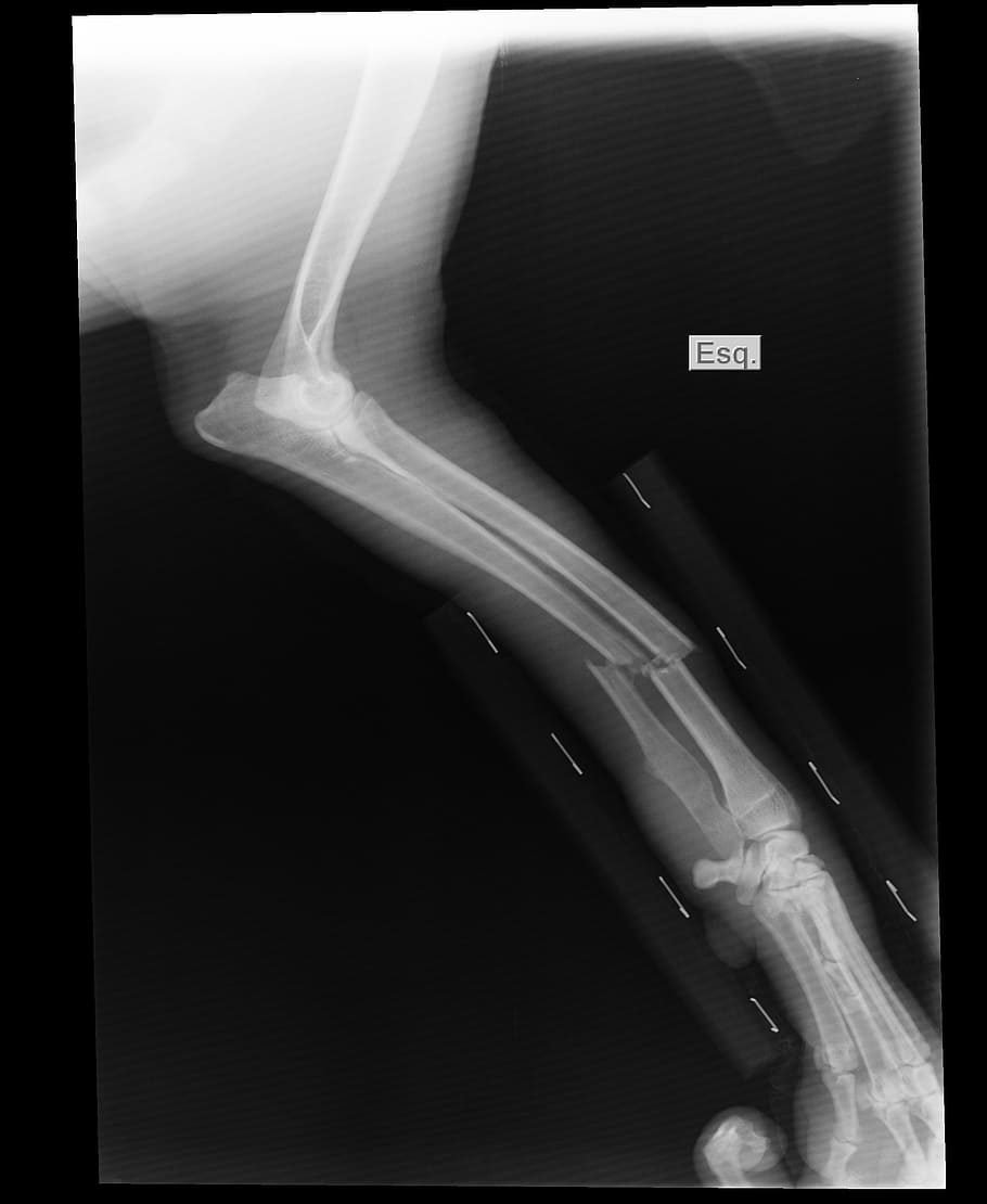 animal x-ray screenshot, broken arm, x-ray, shin, english pointer, x-ray Image, human body part, healthcare and medicine, hand, human hand