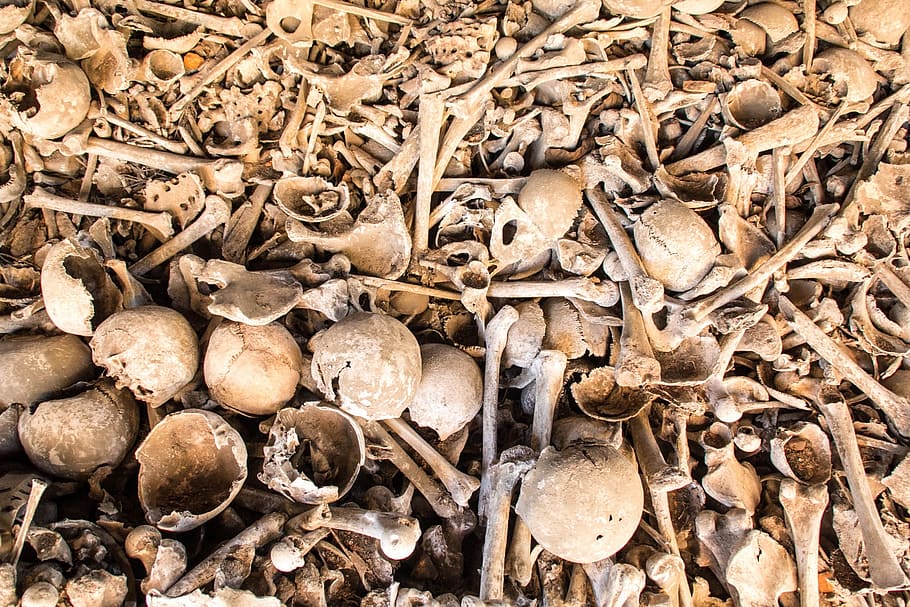 Human, Bones, World War, Death, Bone, human bones, skull, weird, skeleton, war