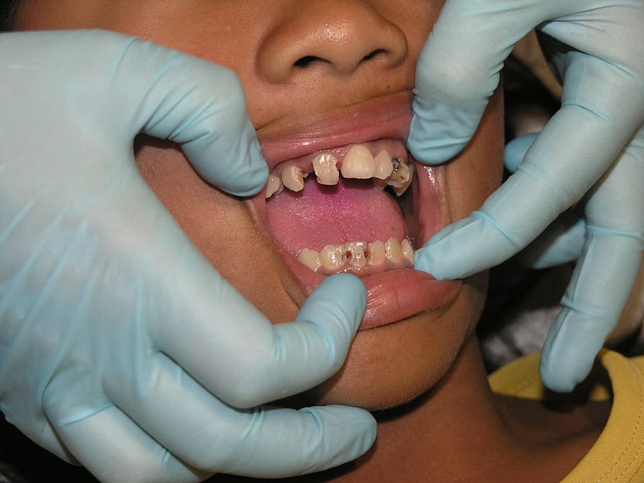 dentist, looking, teeth, person, bad teeth, toothache, dental treatment, human hand, human body part, hand