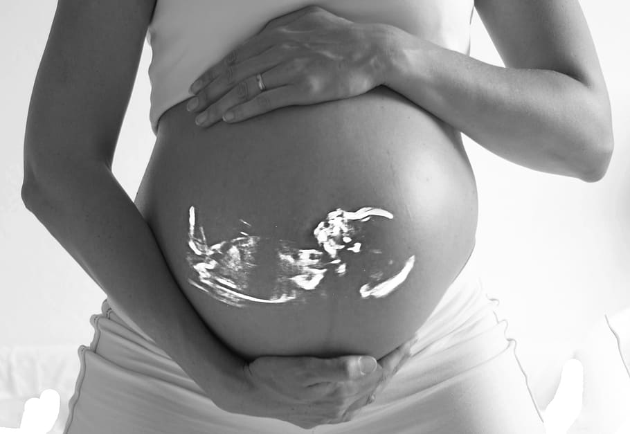 foto grayscale, wanita, memegang, perut, bayi, hamil, gema, ultrasound, kehamilan, keluarga