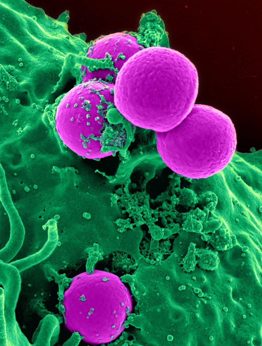 púrpura, verde, micro, bacterias, glóbulos blancos, células, glóbulos, sangre, humanos, microscopio electrónico