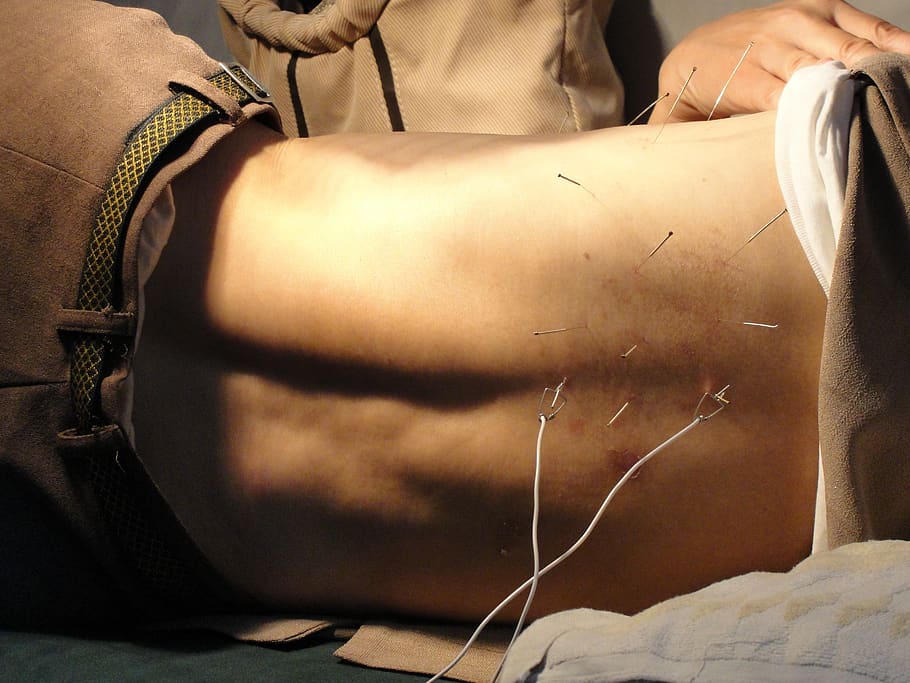 acupuncture, man, needles, therapy, health, treatment, medicine, body, alternative, male