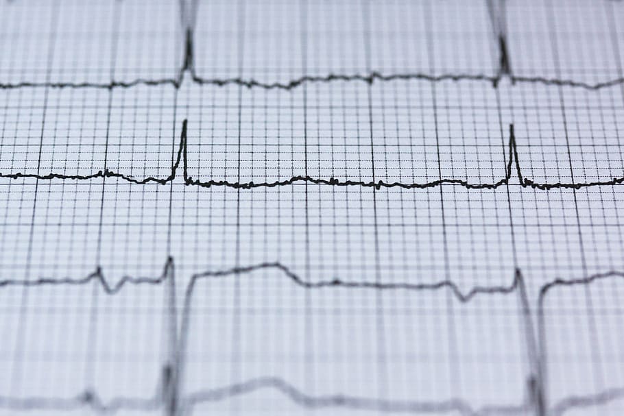 branco, papel gráfico, impressão de linha de onda, ecg, eletrocardiograma, médico, batimento cardíaco, coração, frequência, curva