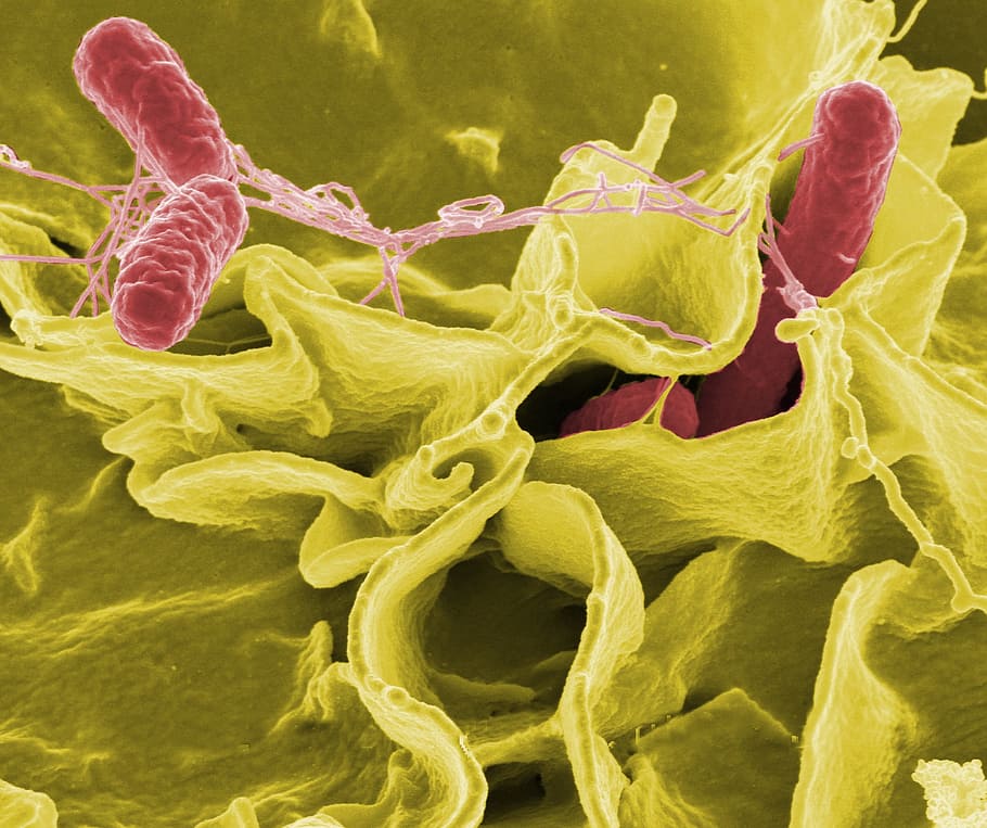 micro, fotografía, verde, rojo, microorganismo, microscópico, vista, bacterias, salmonella, patógenos