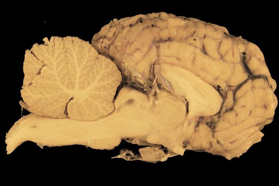 ilustração do cérebro, cérebro, cavalo, seção, anatomia, preparação, cerebelo, tronco cerebral, ciência, biologia