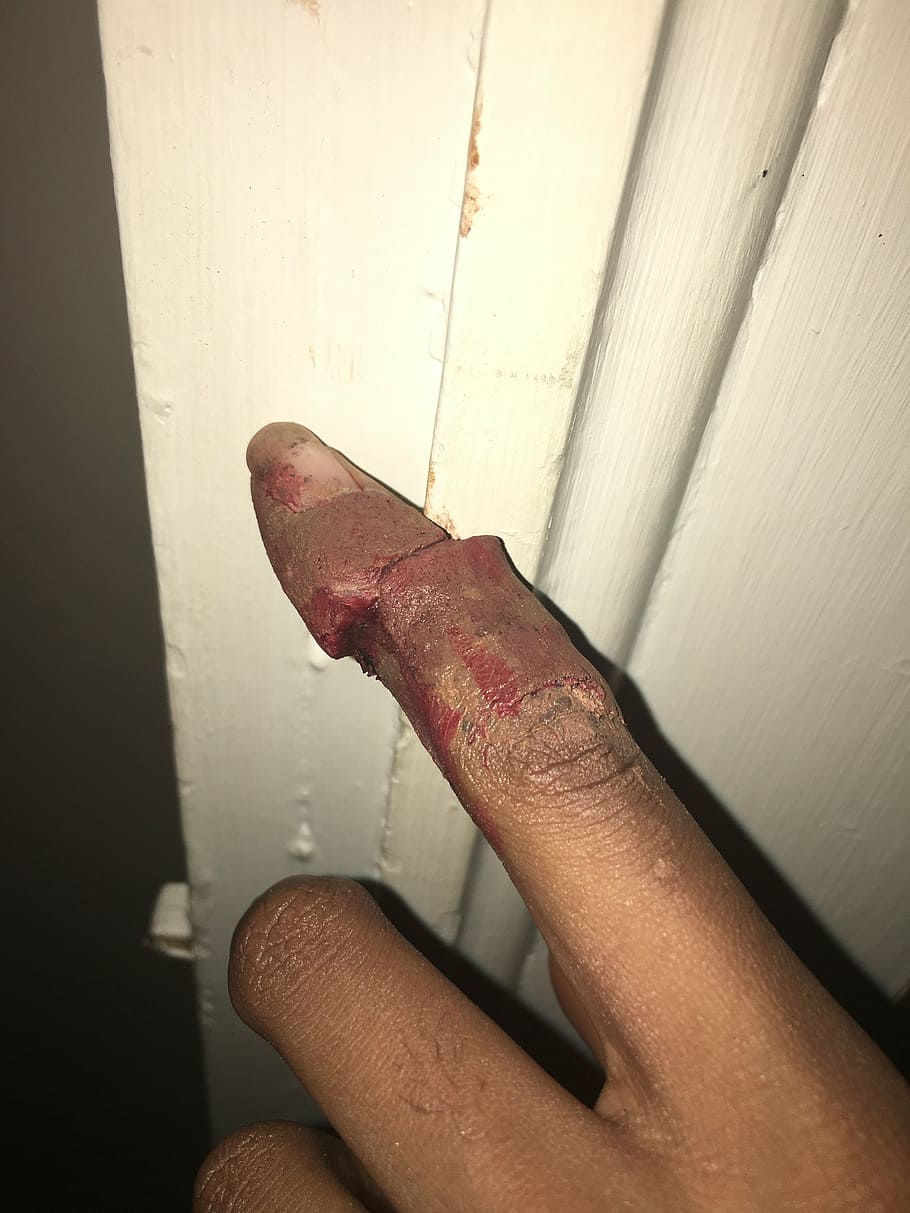 finger, injury, broken, hurt, ouch, slammed, blood, human Hand, people, human body part