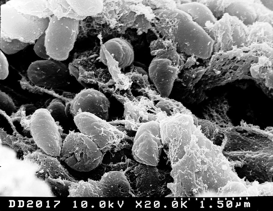 pestis, bacteria, bubonic plague, electron microscope, scan, microscopic, disease, epidemic, medical, illness