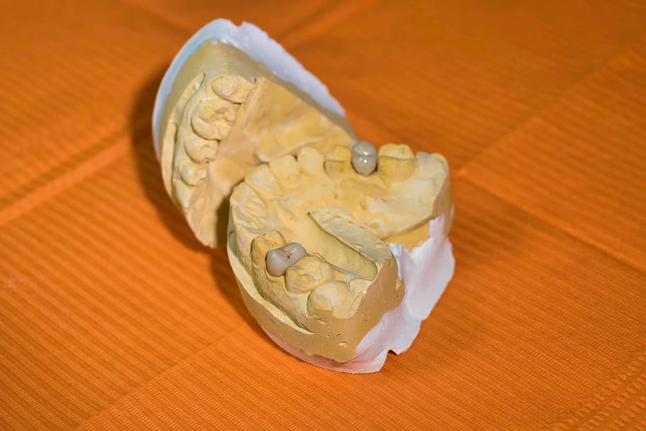 mold, dental, dentist, teeth, molar, reconstruction, plant, form, mouth, ceramics