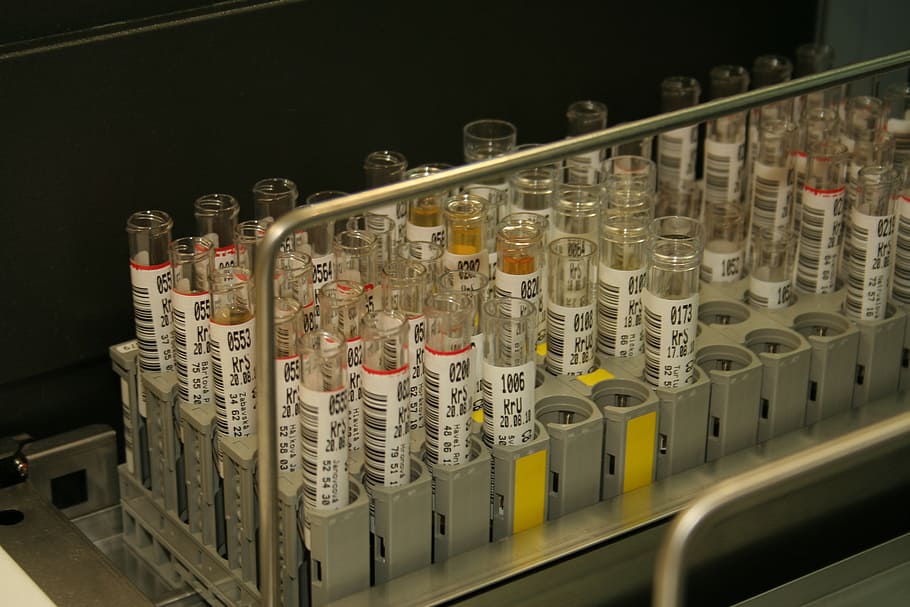 vial on rack, tube, blood, urine, lab, medicine, in a row, indoors, large group of objects, arrangement