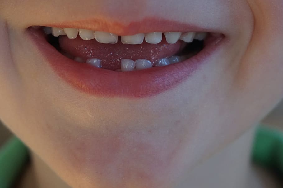pessoa mostrando sorriso, lacuna, dente de leite, criança, rir, dentes de leite, fada dos dentes, orgulho, alegre, uma pessoa