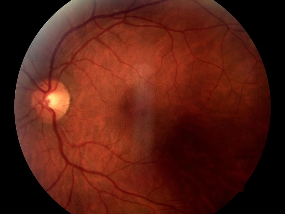 Olho, Globo ocular, Médica, Nervo, fundo preto, parte do corpo humano, espaço, ciência, astronomia, close-up