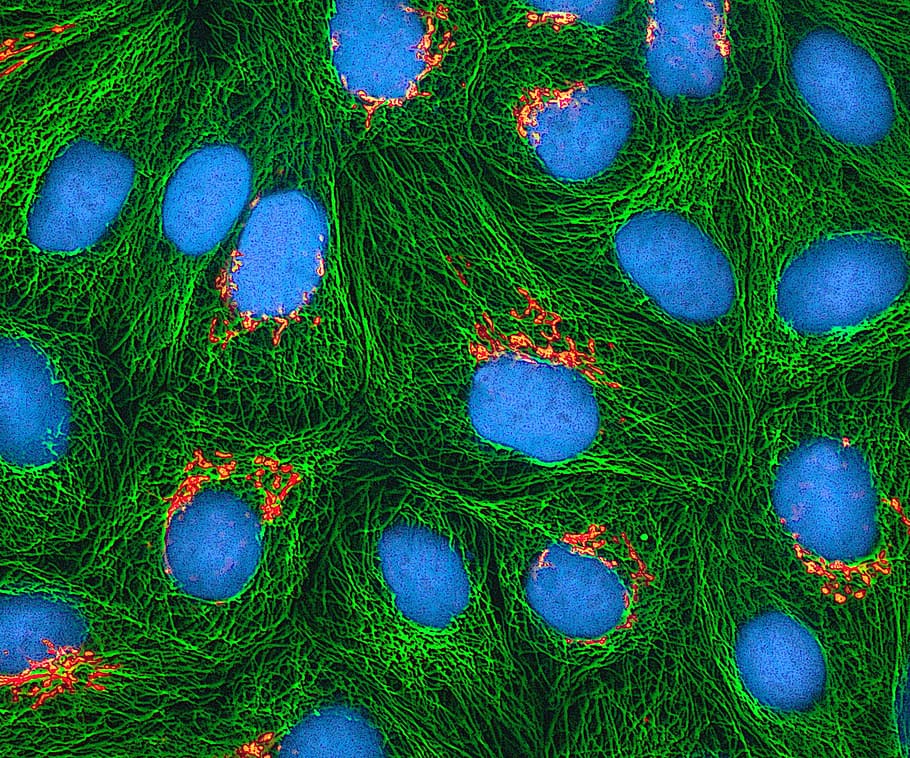 hela cells, cultured, electron microscope, stained, fluorescent protein, microtubules, full frame, green color, blue, backgrounds