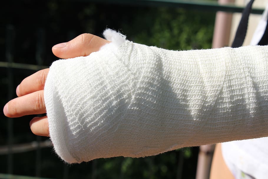 injury, orthopedics, chalk, bandage, care, accident, doctor, bandages, fracture, hand