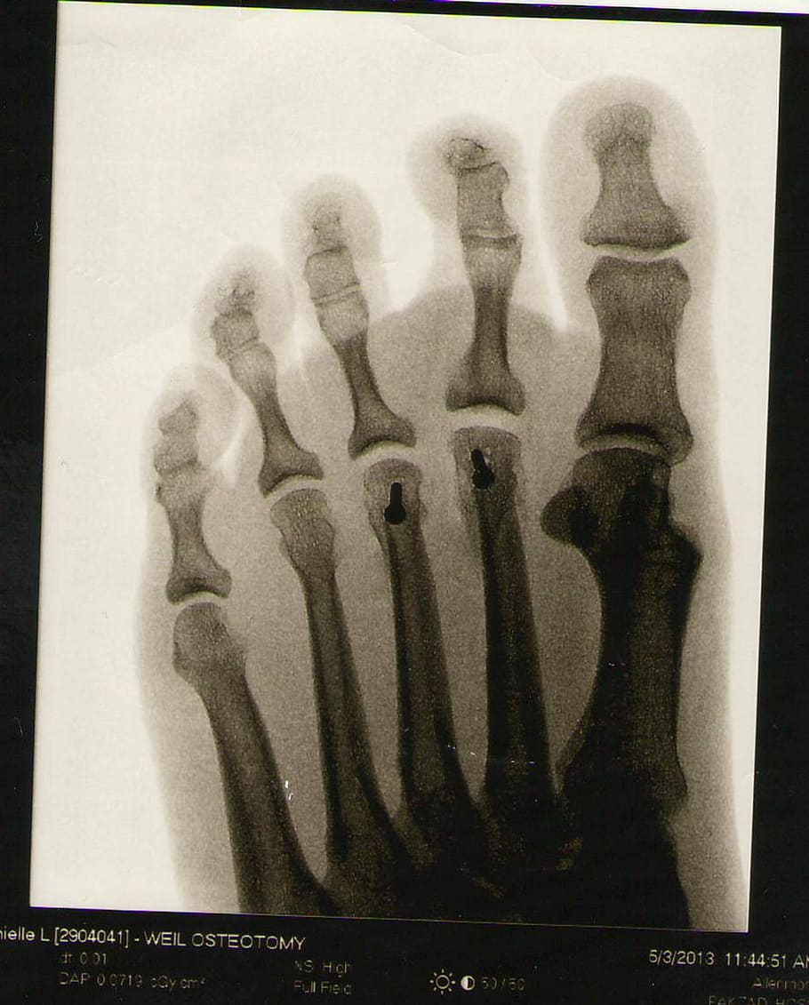 足, X線, スケルトン, 解剖学, 骨, 人間の表現, 人体の一部, 歴史, 像, 彫刻