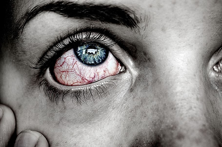 selective, color photography, person, bloodshot, eyes, blue, iris, eye, sick, red