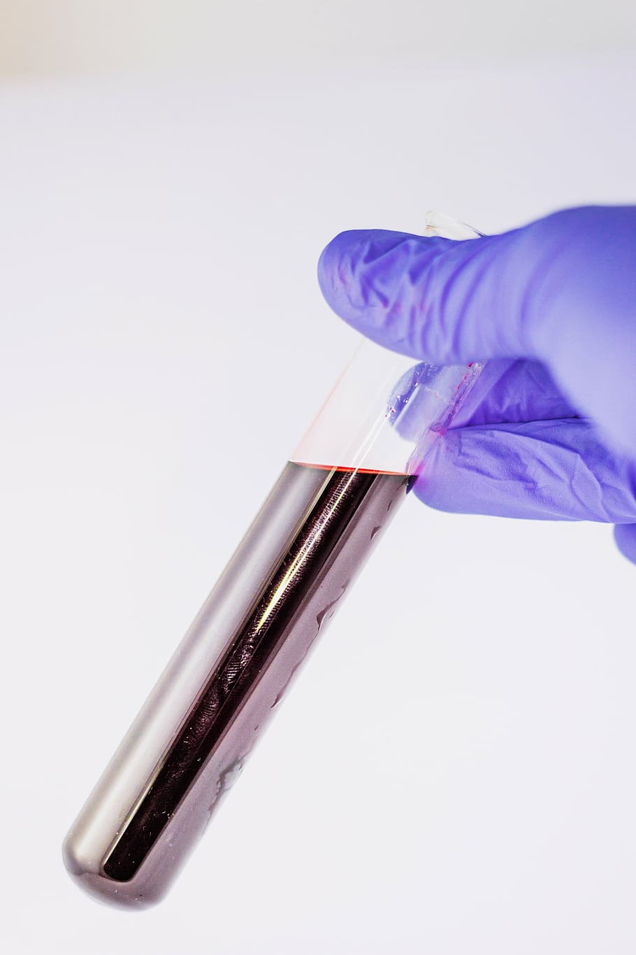 person, purple, gloves, holding, test tube, liquid, blood, medical, attempts, tube