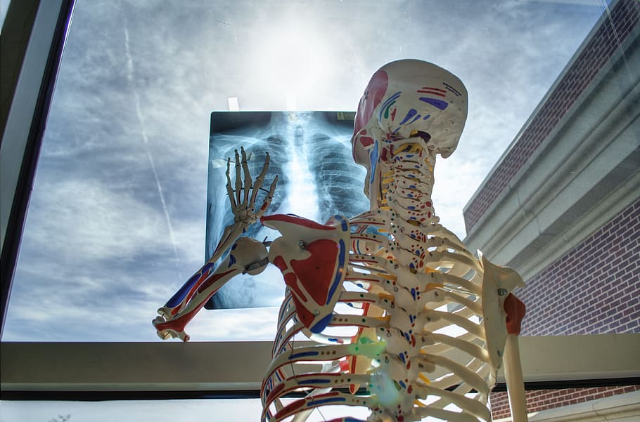 humano, esqueleto, tenencia, papel de rayos x, medicina, tecnología, herramientas, rayos x, cielo, vista de ángulo bajo