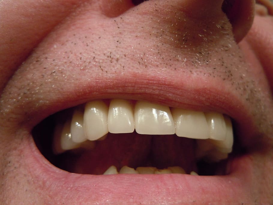 dientes de la persona, dientes, dental, diente, boca, labios, coronas, gorras, cerámica, dientes humanos