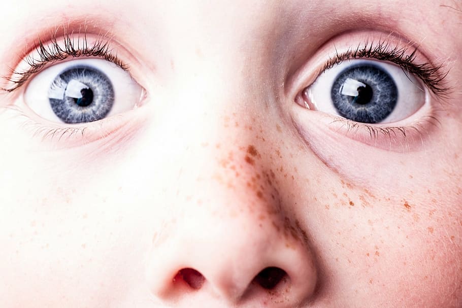 kondisi kulit manusia, terkejut, mata biru, bintik-bintik, melihat, menonton, mata, menakut-nakuti, wajah, tangguh