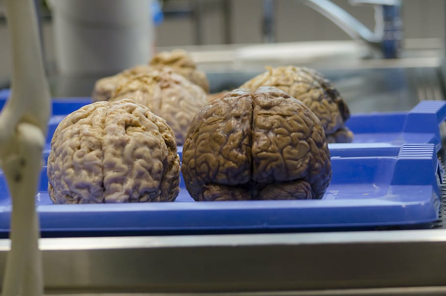 cérebro, azul, bandeja, o cérebro, ciência médica, cirurgia, hospital, o corpo de, comida e bebida, comida