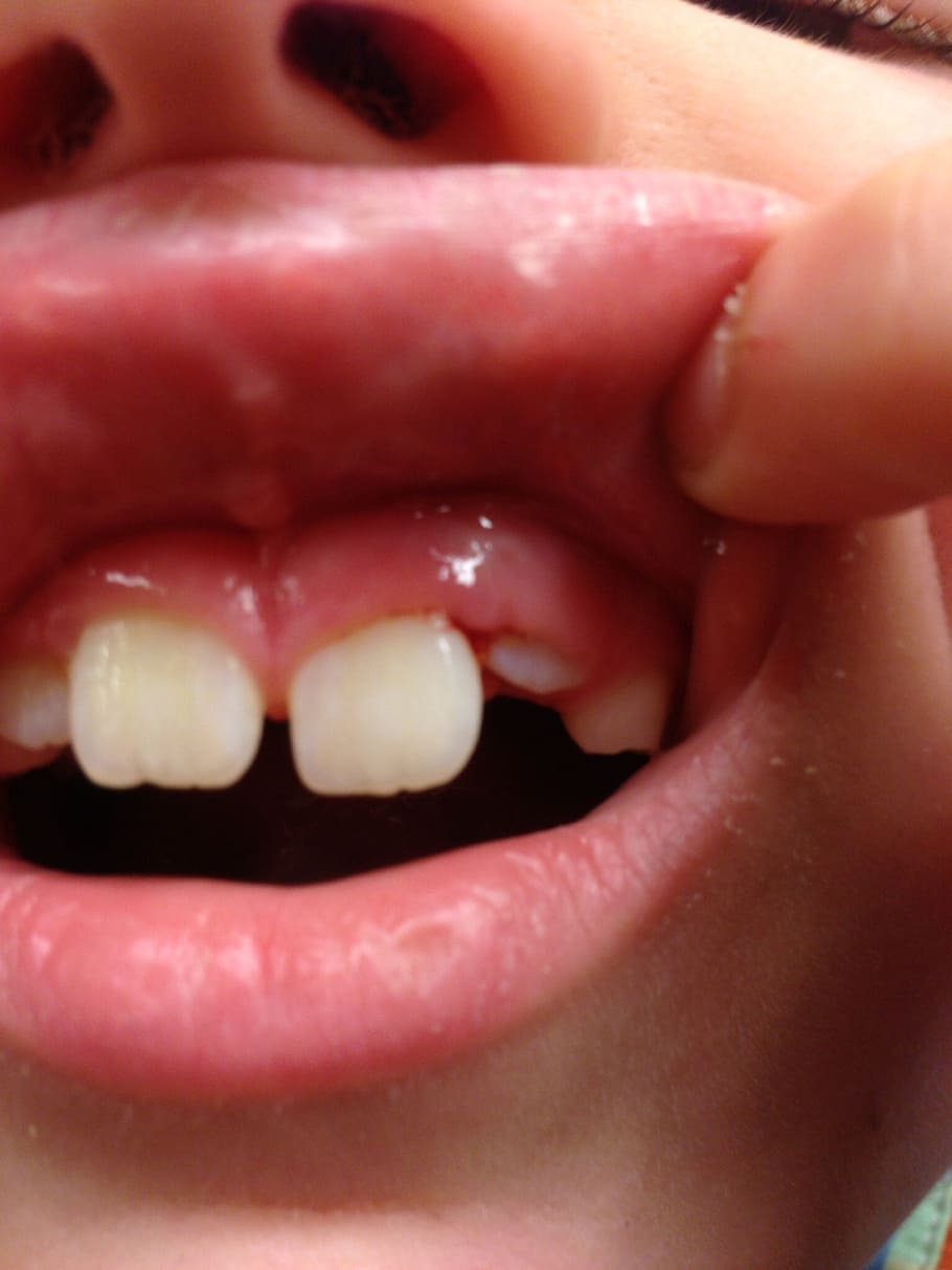teeth, mouth, dental, human body part, one person, body part, close-up, human mouth, human lips, human hand