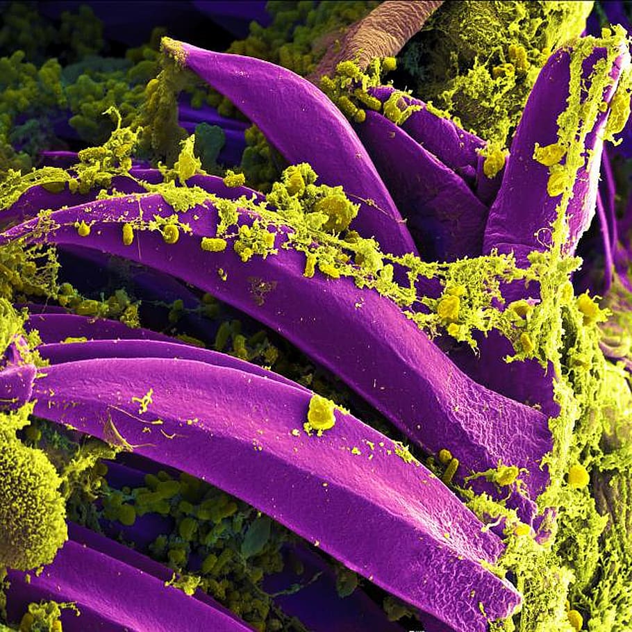 flor de pétalo púrpura, púrpura, flor, bacterias, microscopio electrónico, púrpura teñida, peste bubónica, y pestis, bacteria, patógeno