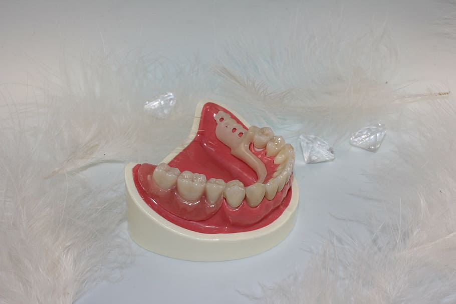 gigi tiruan, putih, kasus, penggantian gigi, gigi, teknisi gigi, gigi palsu, gigi manusia, dokter gigi, peralatan prostetik