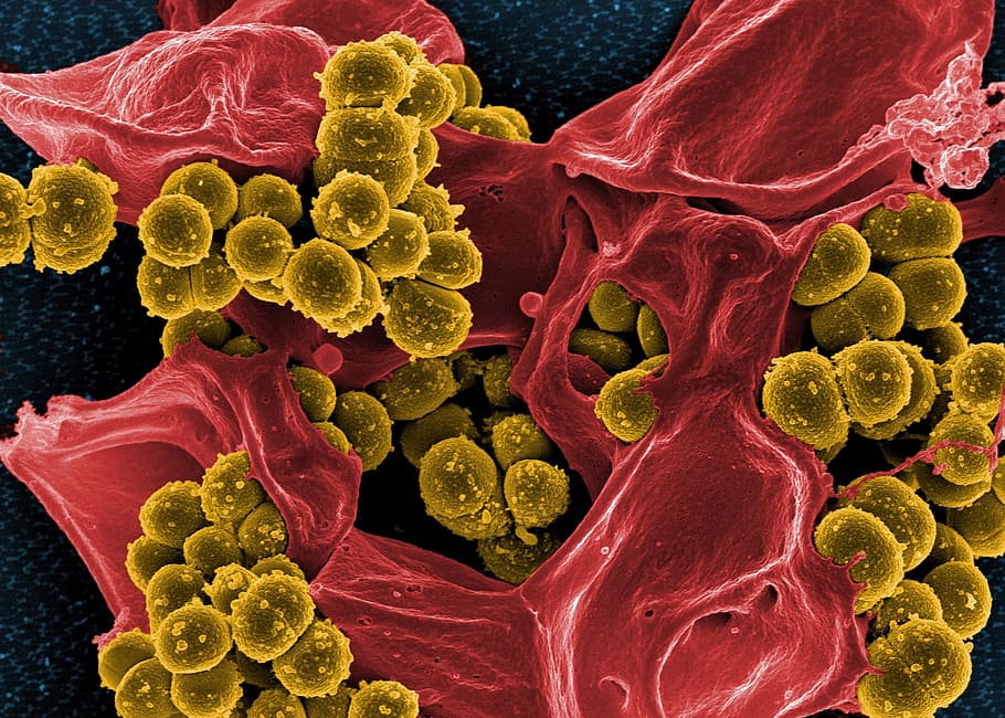 microscópico, fotografia, bactérias, microscópio eletrônico, manchado, verde, staphylococcus aureus, esferóide, resistente à meticilina, bactéria