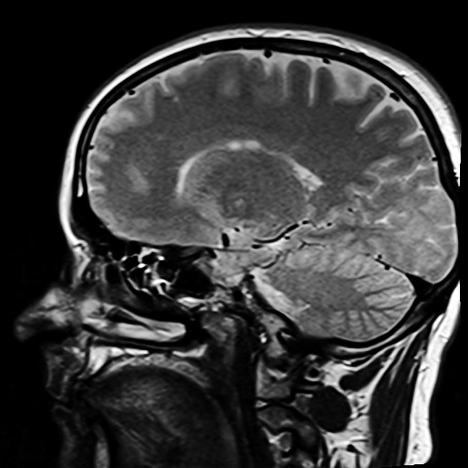 raio x da cabeça humana, cabeça, ressonância magnética, mrt, raio x, imagem de raio x, cérebro, cuidados de saúde e medicina, fundo preto, parte do corpo humano