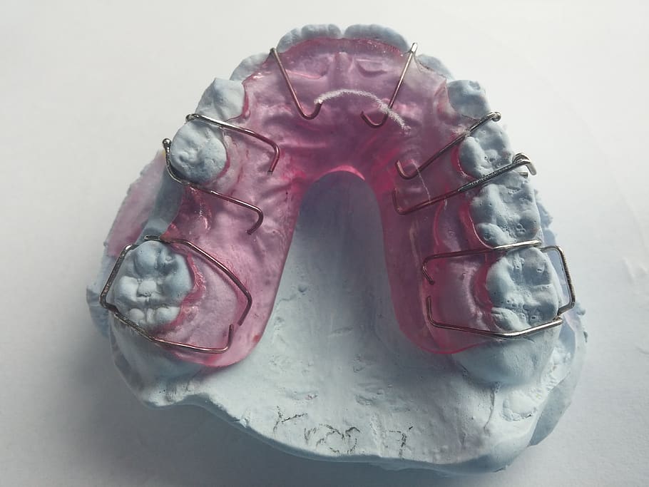 dentista, ortodontia, trilho dentário, trilhos, aparelho dentário, dente, close-up, boca, mordida, cabeça