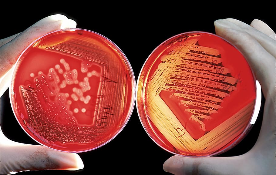 person, holding, two, red, bowls, agar, breeding ground, blood cells, experiment, research