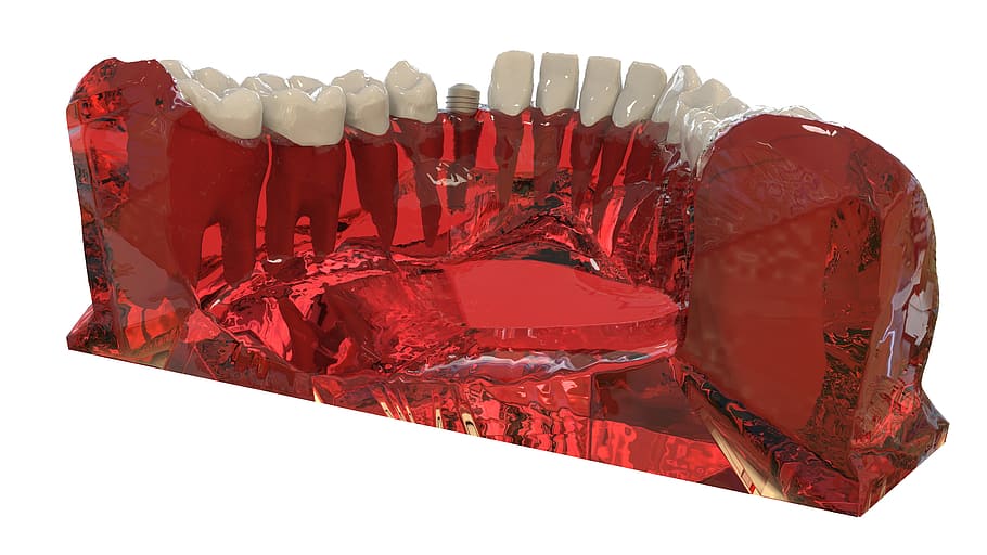 teeth, jaw, 3d model, orthodontics, the implant, red, white background, studio shot, cut out, indoors