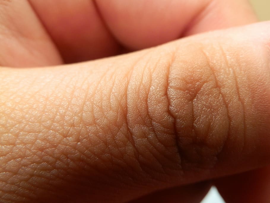 палец, кожа, рука, часть человеческого тела, человеческая кожа, часть тела, крупный план, люди, человеческая рука, взрослый