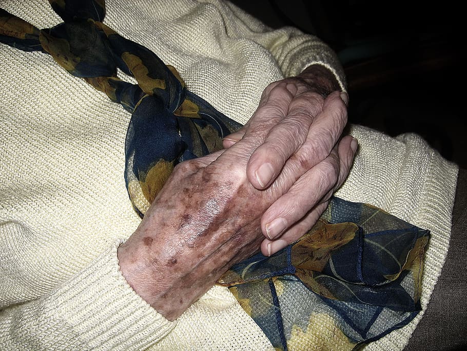 person skin condition, Hands, Woman, Old, Age, Age Spots, Pray, woman old, age, fold, folded