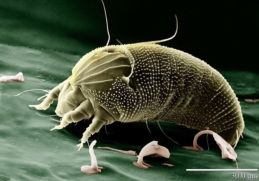 gray microorganism, mite, aceria anthocoptes, acari, arachnid, spider, electron microscope, eriophyidae, electron micrograph, enlarged