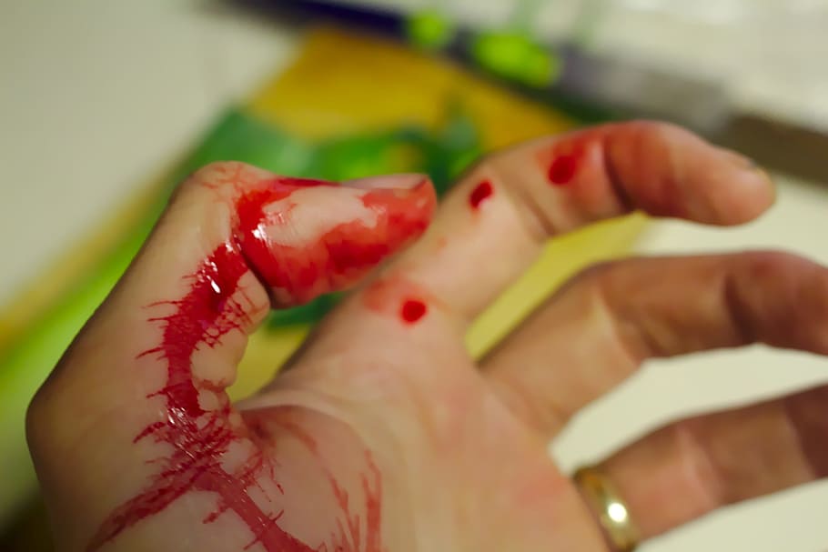 wound hand, blood, untitled, accident, bleed, bleeding, bleeding finger, chopping, chopping board, cut