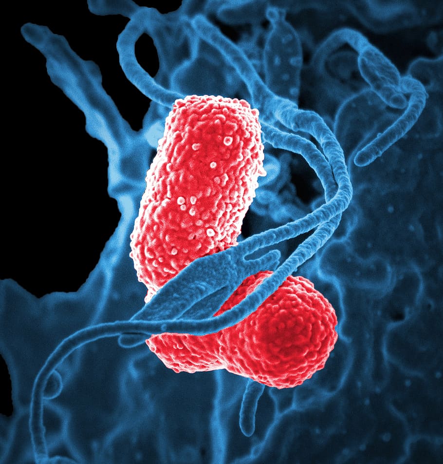 azul, rojo, ilustración de parásito, bacterias, microscopio electrónico, Klebsiella pneumoniae, rojo teñido, neumonía, bacteria, patógeno