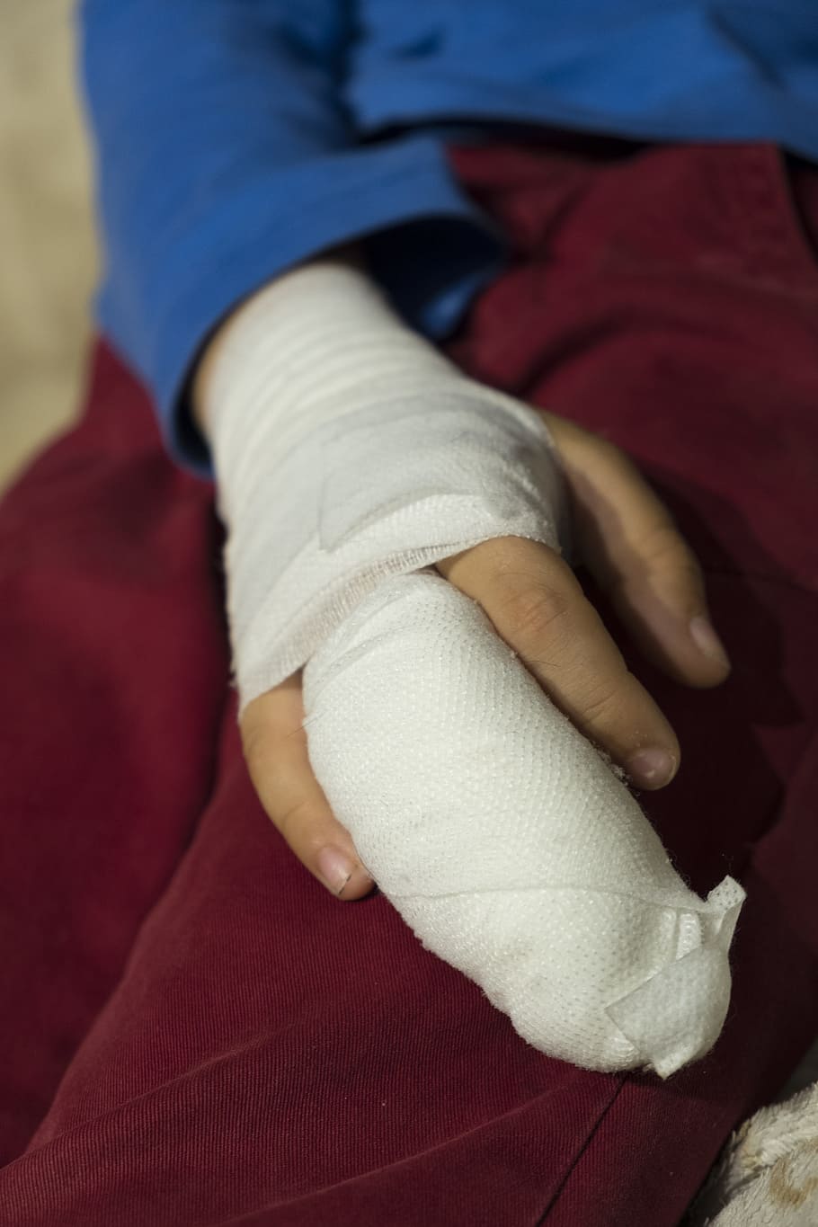 person, wearing, white, hand cast, child, boy, injury, injured, association, bandages
