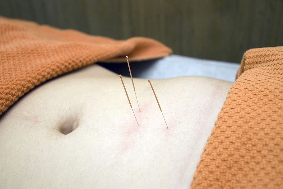acupuncture, physiotherapy, wellness, relax, bless you, cure, osteopathy, therapy, stress, human body part
