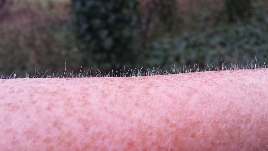 goose bumps, freckles, cold, pink color, close-up, day, backgrounds, outdoors, nature, human body part
