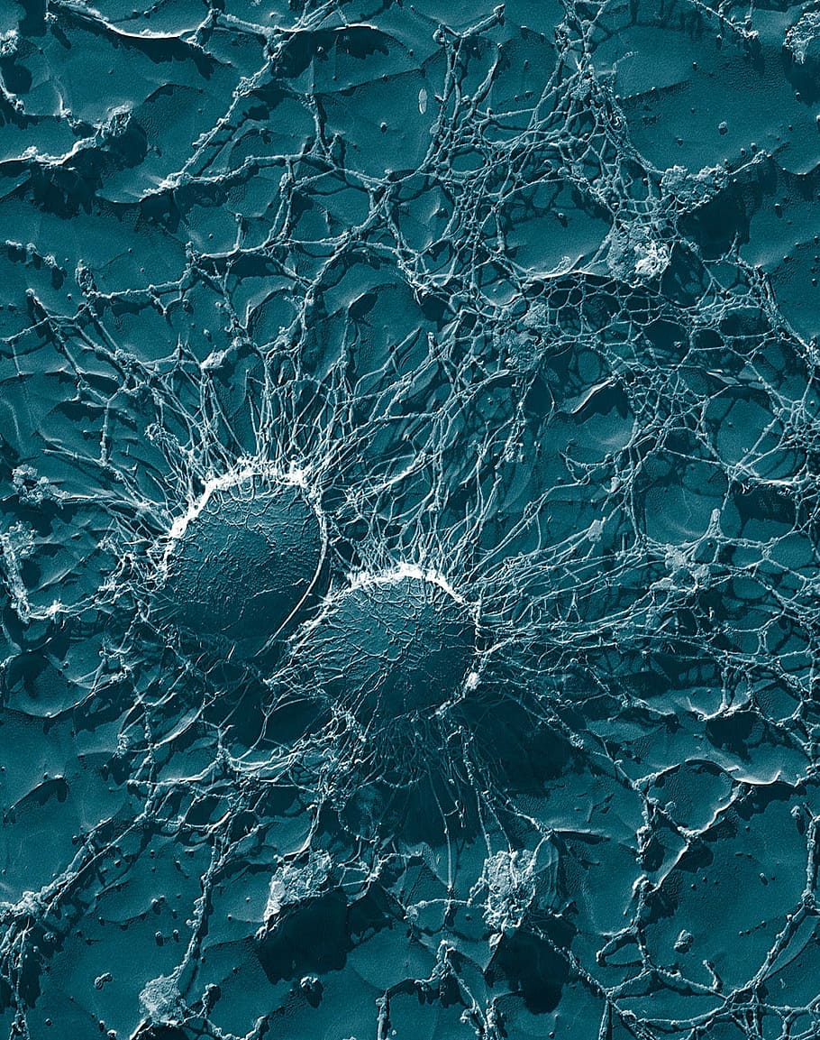 teal, white, decor, bacteria, cocci, staphylococci, staphylococcus, pathogens, disease, electron microscopy