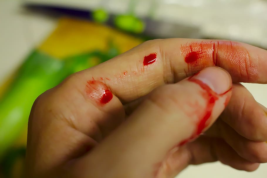 left, human, hand, blood, accident, bleed, bleeding, bleeding finger, chopping, chopping board
