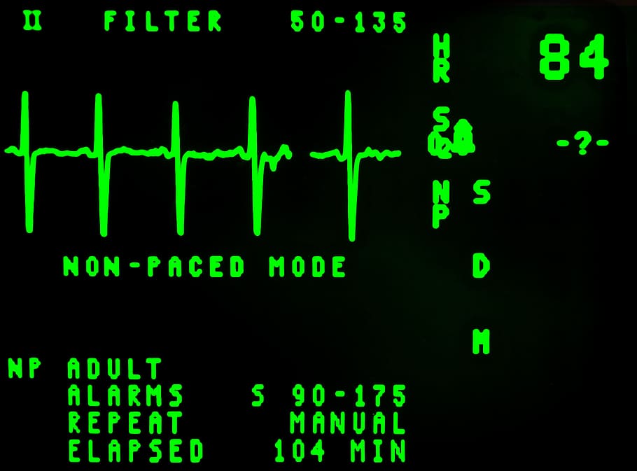 corazón, latido, lectura, 84, Modo, electrocardiograma, cardiología, pantalla, emergencia, frecuencia
