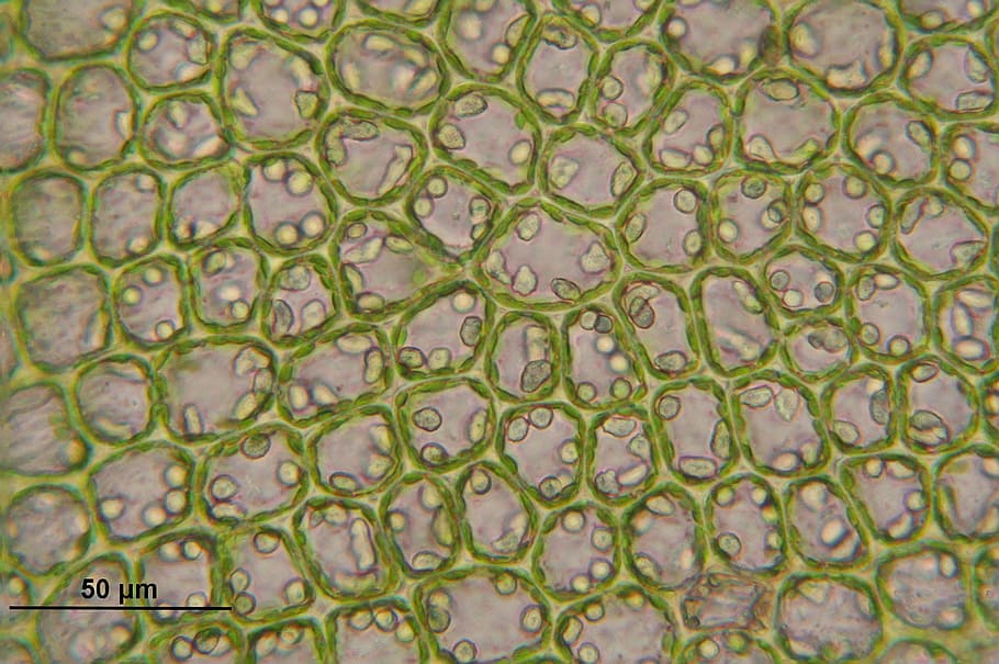 Barbilophozia, Cells, Liverwort, barbilophozia floerkei, microscopic, macro, biology, science, full frame, backgrounds