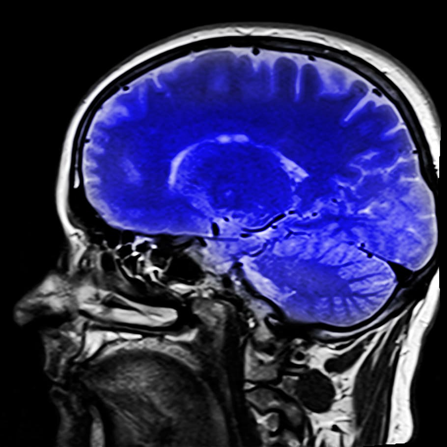 pemindaian ct, manusia, otak, kepala, pencitraan resonansi magnetik, mrt, x ray, gambar x ray, biru, anatomi
