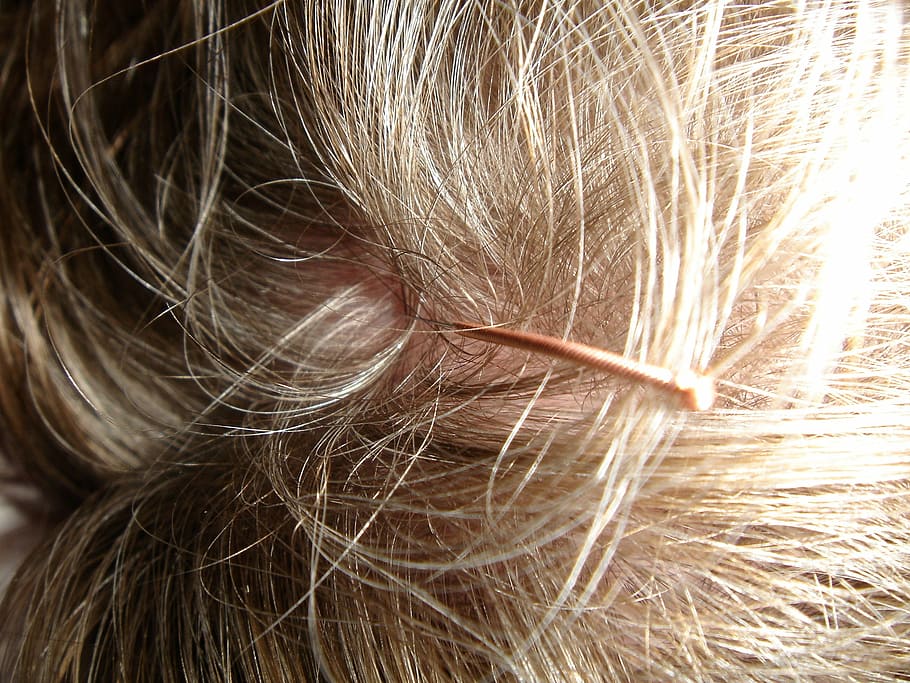 rambut manusia, akupunktur, jarum akupunktur, kulit kepala, jarum, kepala, rambut, memberkati Anda, pengobatan alternatif, tcm