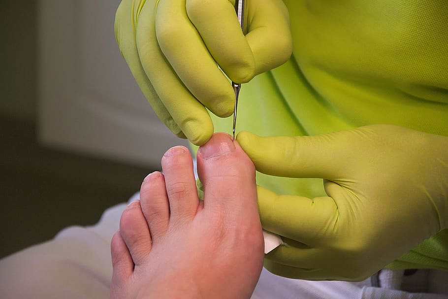 foot care, podiatry, treatment, feet, human hand, hand, human body part, body part, yellow, people