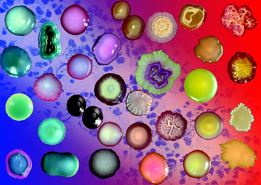 bacterias, colonias, tinción de Gram, ninguna gente, gran grupo de objetos, esfera, aumento, multicolores, biología, interiores