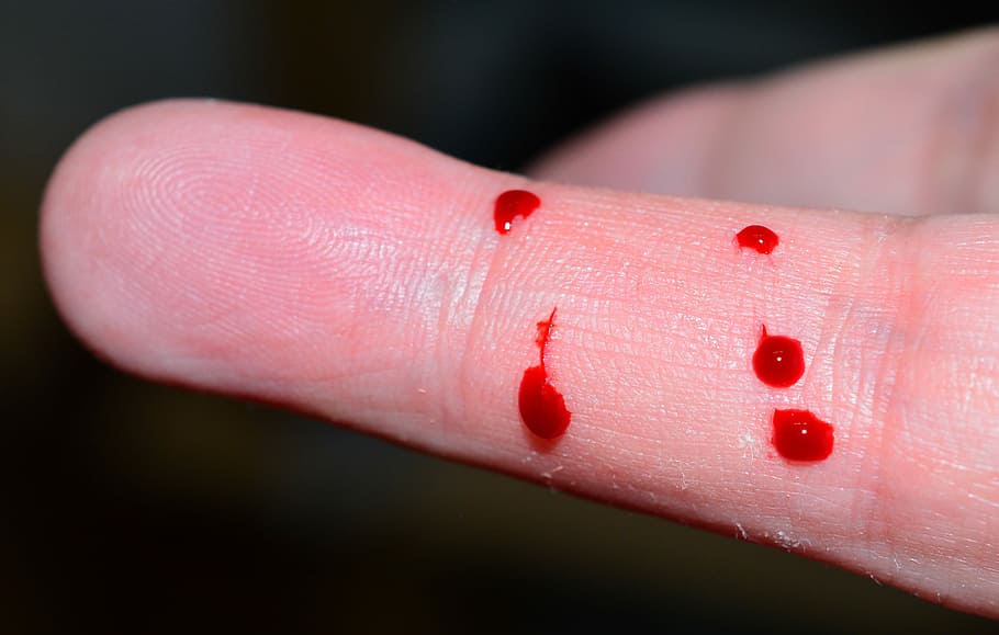 指の血, 指, 点滴, 滴, 血, 赤, 血の滴, ビット, ヘビ, 非毒性