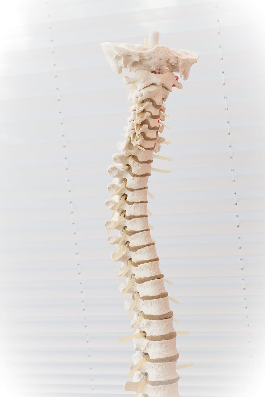 사람의, 척추 뼈 장식, 척추, 디스크, 움직임, 요추 추간판 탈출증, 질병, 의료, 뼈, 고치다